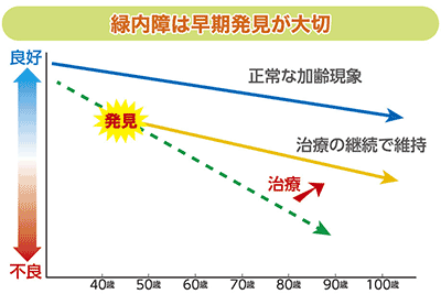 緑内障は早期発見が大切 